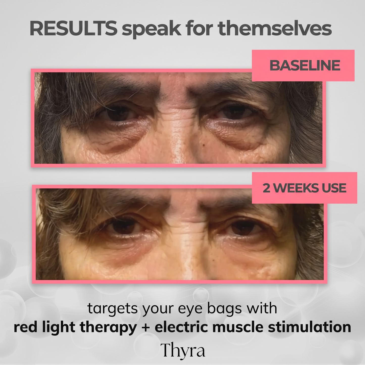 Thyra Redlight Therapy Massaging Glasses - 50% OFF SALE